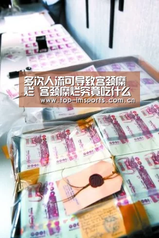 多次人流可导致宫颈糜烂 宫颈糜烂究竟吃什么好‘im赛事’(图2) im体育官方网站